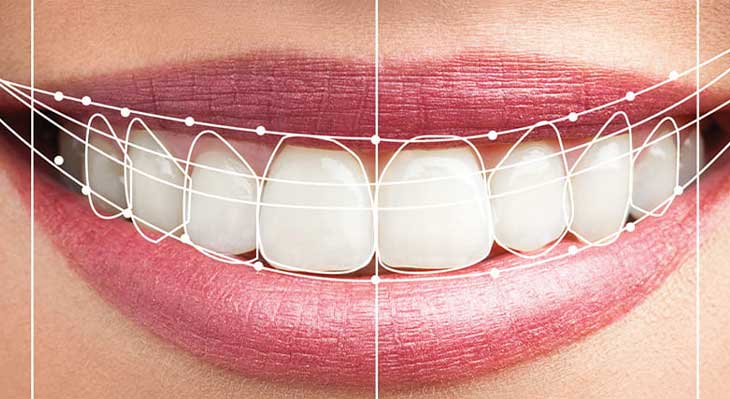 اصلاح طرح لبخند