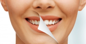 اصلاح طرح لبخند