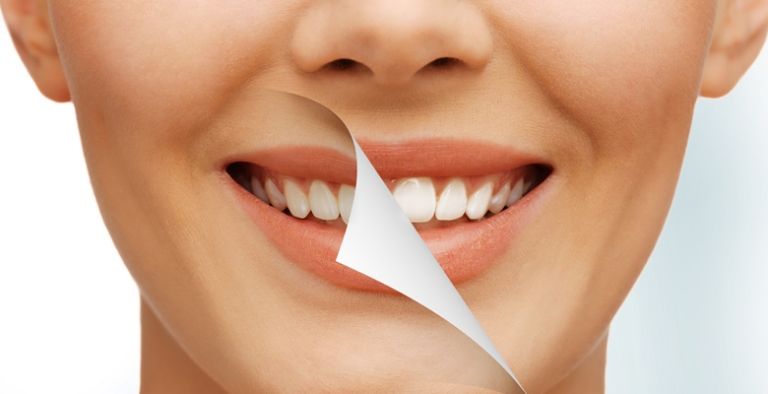 اصلاح طرح لبخند