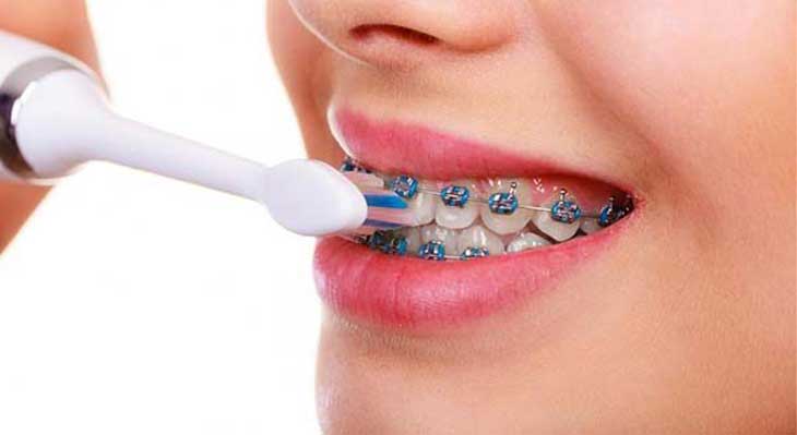 رابطه ارتودنسی و عفونت دندان