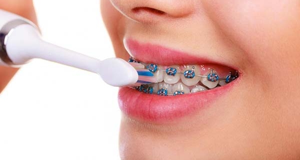 رابطه ارتودنسی و عفونت دندان