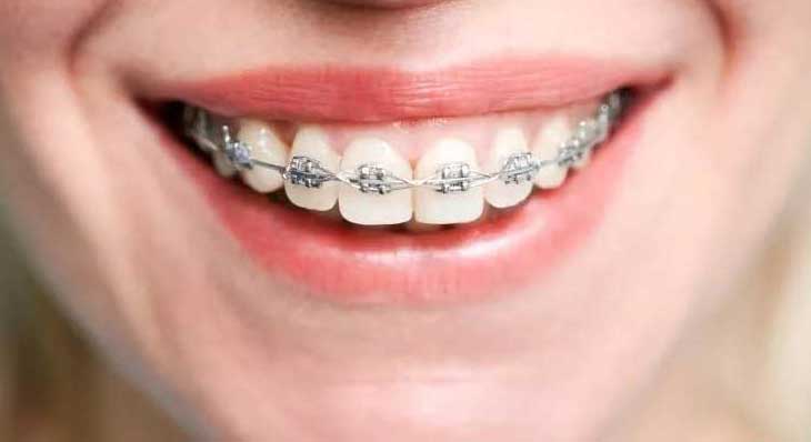 دیپ بایت