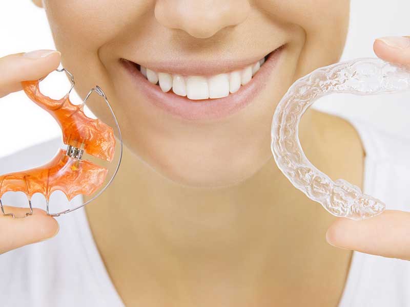 مراقبت های ارتودنسی متحرک