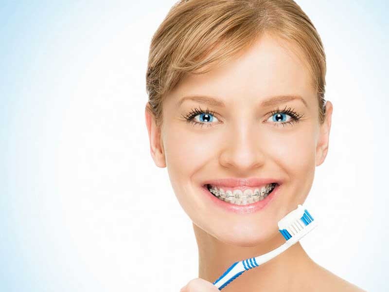 مراقبت های ارتودنسی متحرک