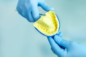 قالب گیری ارتودنسی