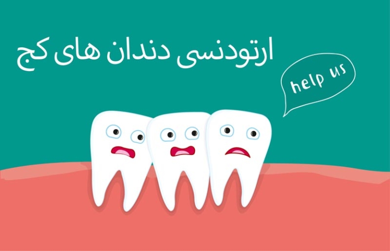 ارتودنسی دندان های کج