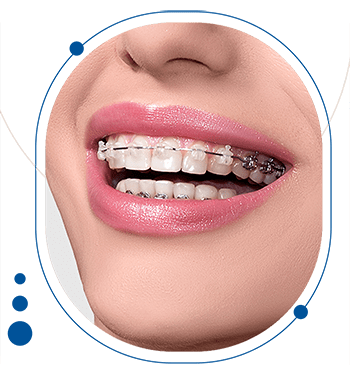 ارتودنسی متحرک توسط متخصص ارتودنسی دکتر احسان مهریزی