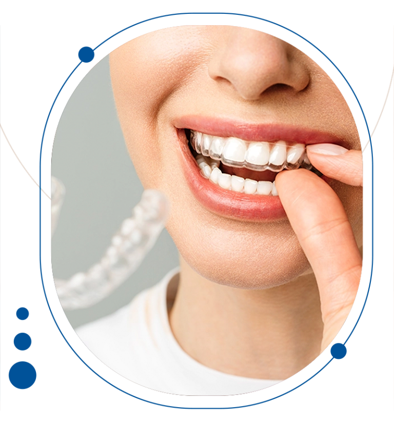 ارتودنسی نامریی توسط متخصص ارتودنسی دکتر احسان مهریزی