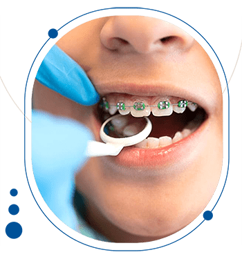 ارتودنسی کودکان توسط متخصص ارتودنسی دکتر احسان مهریزی