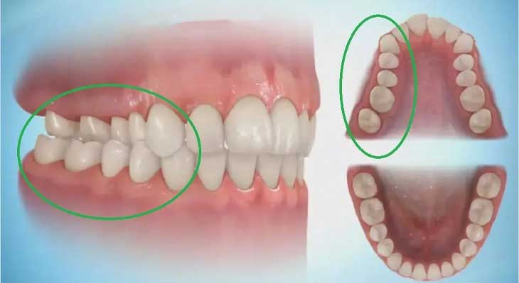 بایت معکوس