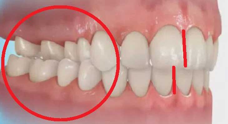 تفاوت کراس بایت و بایت معکوس