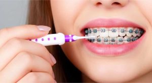 مسواک مخصوص ارتودنسی