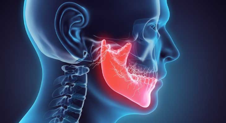 آرتروز فک چیست؟