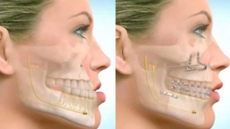 جراحی فک یا ارتودنسی