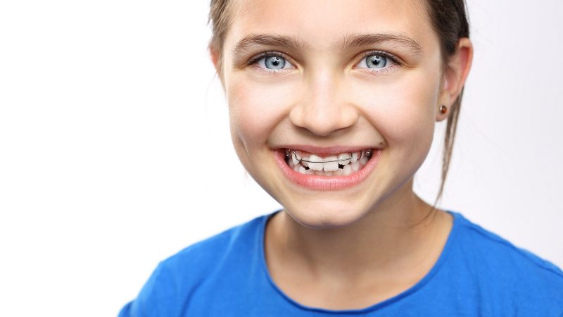 Do-All-Your-Baby-Teeth-Need-To-Fall-Out-Before-You-Get-Braces