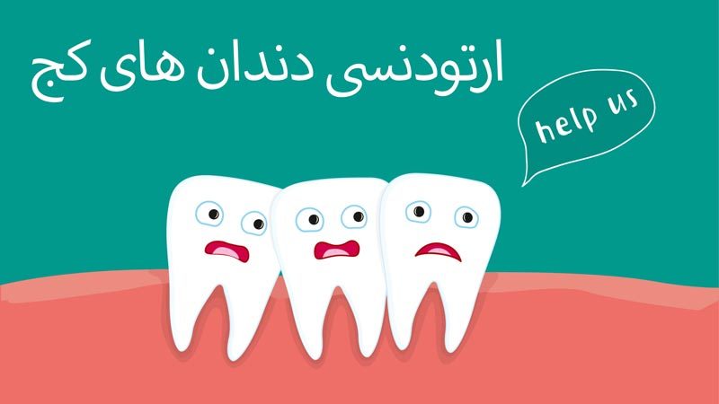 ارتودنسی دندان های کج