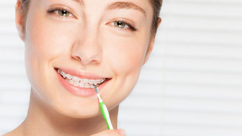 مسواک ارتودنسی بین دندان چیست؟